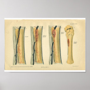 Vintage Horse Anatomy Print Splint