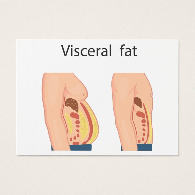 Visceral fat (Front)