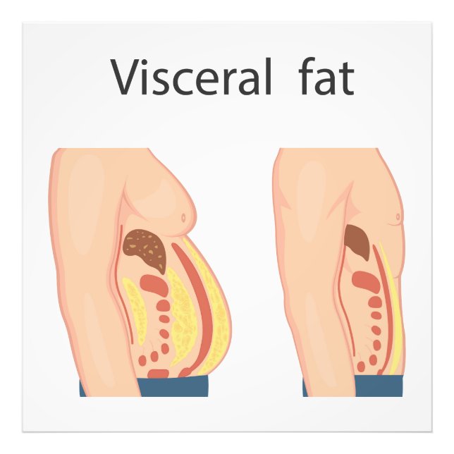 Visceral fat photo print (Front)