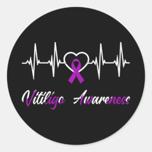 Vitiligo Awareness Heartbeat Love Purple Ribbon Su Classic Round Sticker