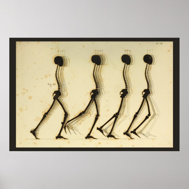 Walking Gait Analysis Leg Spine Chiropractic Chart (Front)