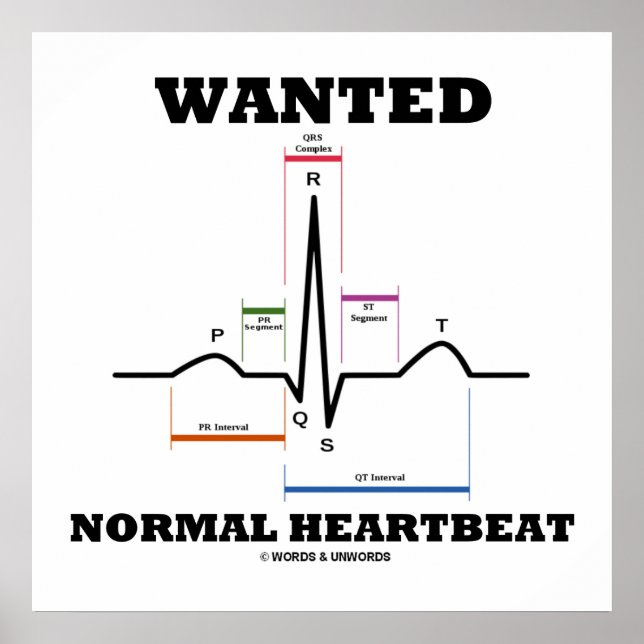 Wanted Normal Heartbeat ECG Electrocardiogram Poster (Front)