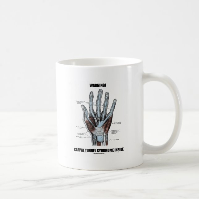 Warning! Carpal Tunnel Syndrome Inside (Anatomy) Coffee Mug (Right)