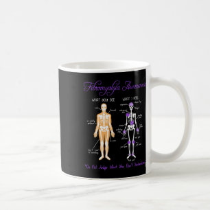 What You See What I Feel Skeleton Fibromyalgia Awa Coffee Mug