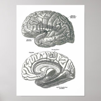 White Matter Tracts of the Brain Poster