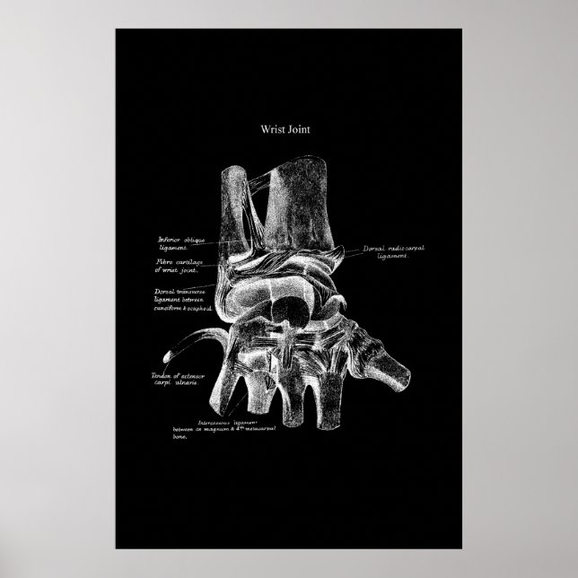 Wrist Anatomy Medical Poster Orthopaedic Decor (Front)