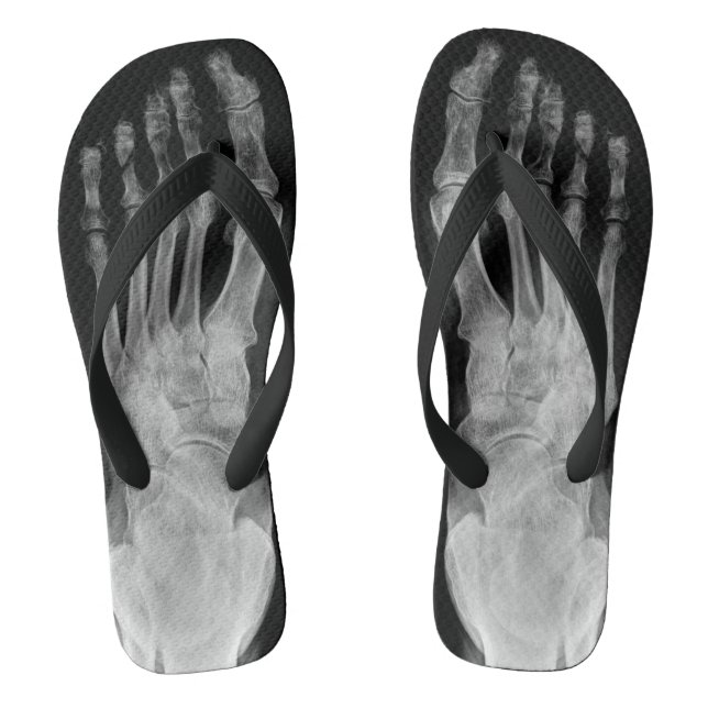X ray anatomy skeleton feet cool flip plops thongs (Footbed)