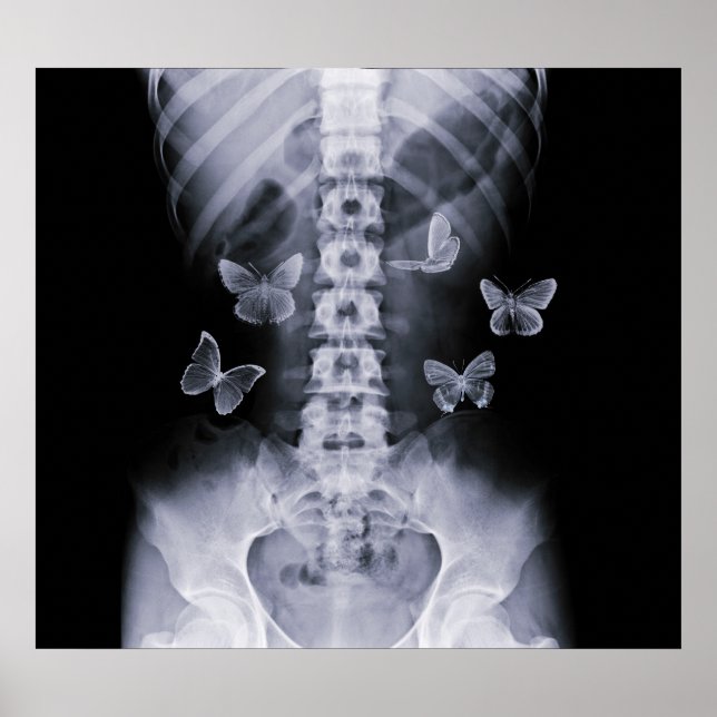 X-Ray Anticipatory Conceptual Butterflies Poster (Front)