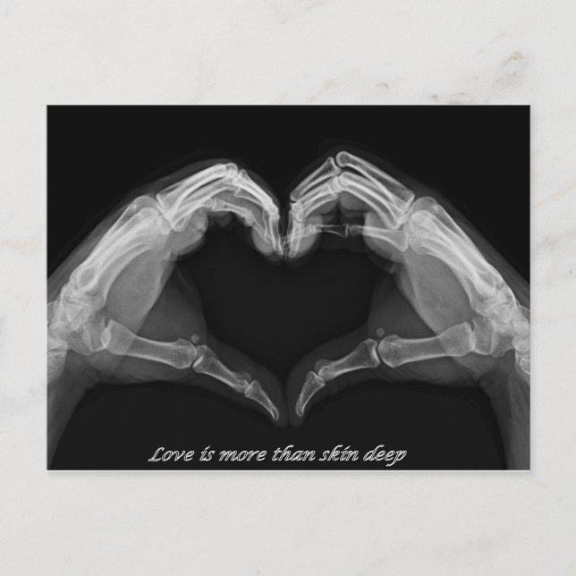 X-Ray Art Postcard (Front)