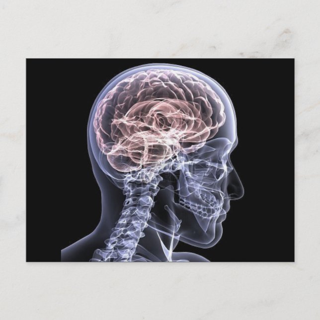 X-Ray Brain Postcard (Front)