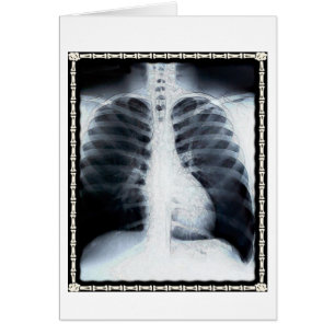 X-Ray Chest
