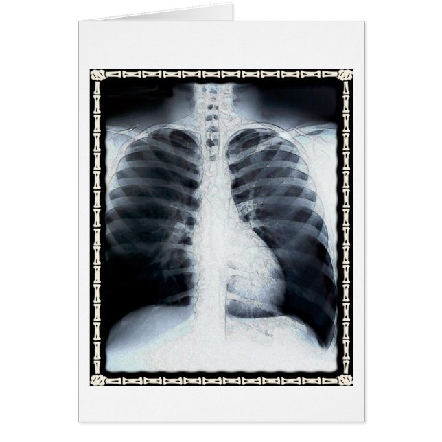 X-Ray Chest (Front)