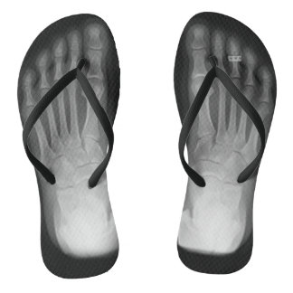 X-Ray Feet Flip Flops (with toe ring)