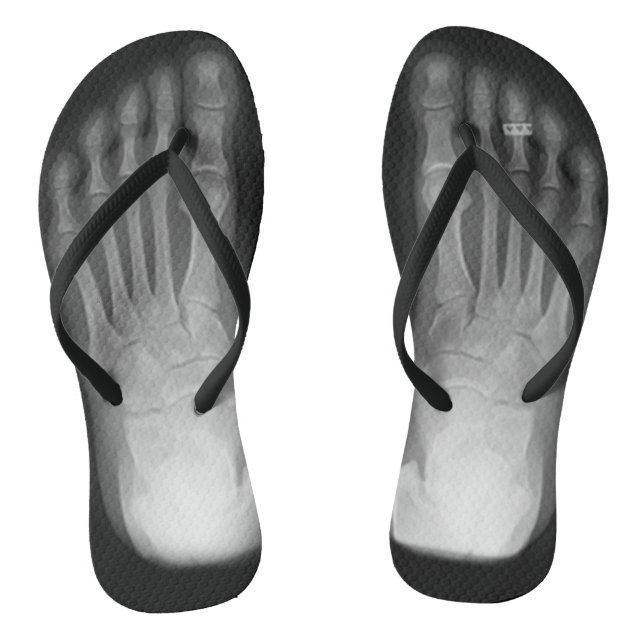X-Ray Feet Flip Flops (with toe ring) (Footbed)