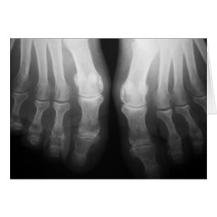 X-Ray Feet Human Skeleton Bones Black & White