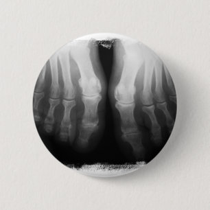 X-Ray Feet Human Skeleton Bones Black & White 6 Cm Round Badge