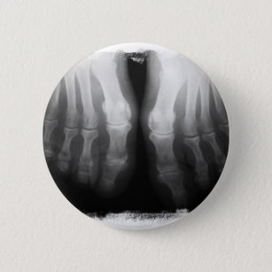 X-Ray Feet Human Skeleton Bones Black & White 6 Cm Round Badge