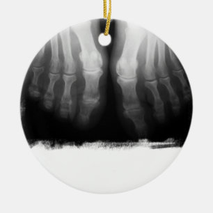X-Ray Feet Human Skeleton Bones Black & White Ceramic Ornament