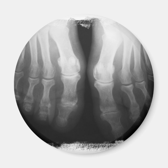 X-Ray Feet Human Skeleton Bones Black & White Magnet (Front)