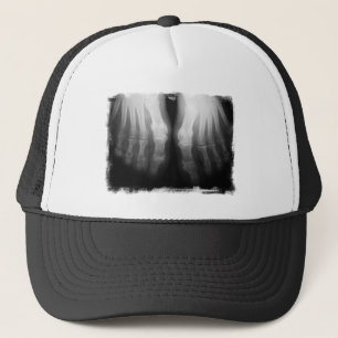 X-Ray Feet Human Skeleton Bones Black & White Trucker Hat