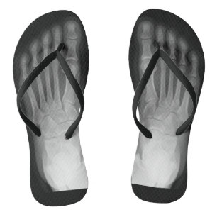 X-Ray Feet! Thongs