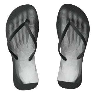 X-Ray Feet! Thongs