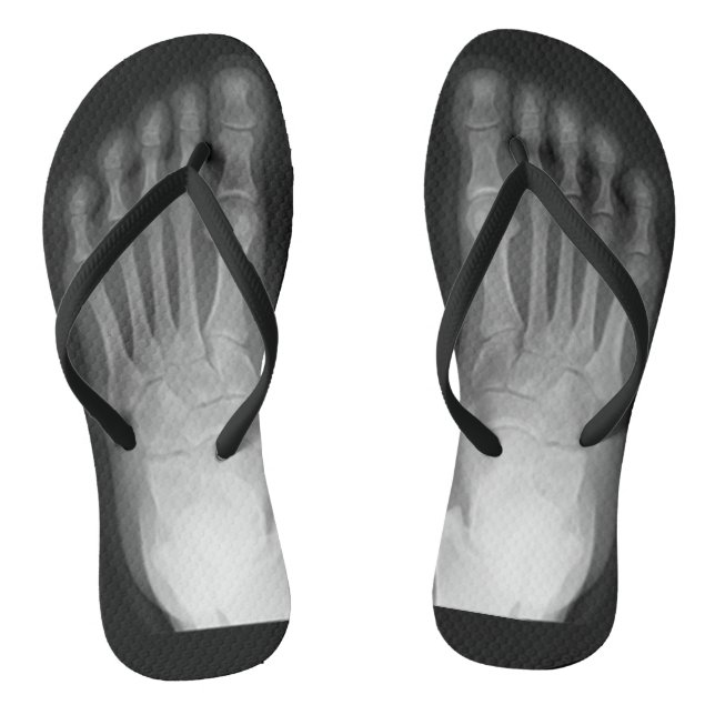 X-Ray Feet! Thongs (Footbed)