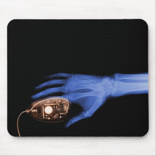 X-Ray Hand & Computer Mouse Pad