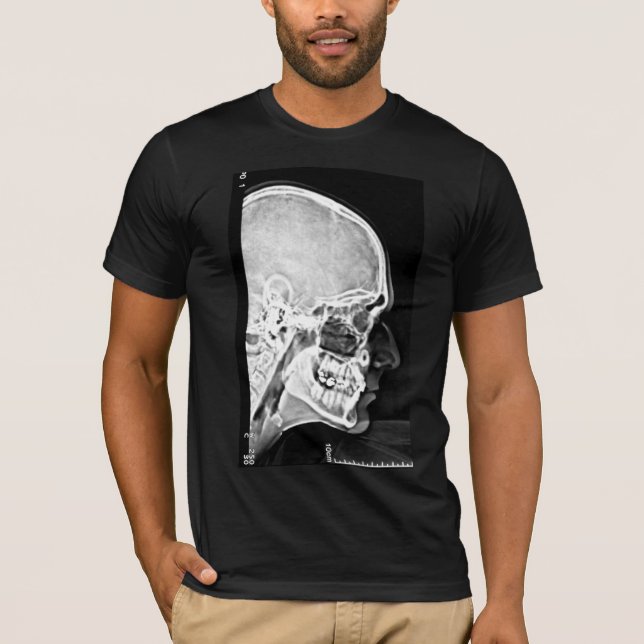 X-Ray Head T-Shirt (Front)