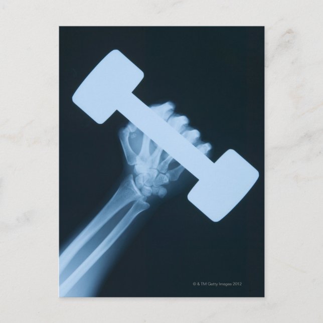 X-ray image of human hand with weight, close-up postcard (Front)