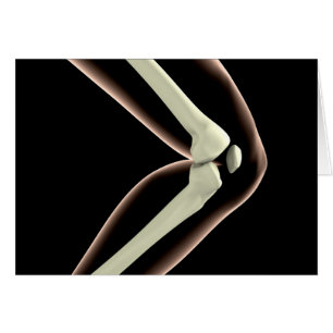 X-Ray Image Of Knee 1