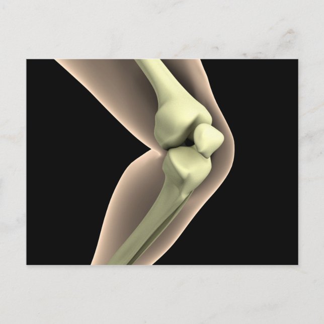 X-Ray Image Of Knee 2 Postcard (Front)