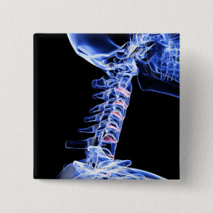 X-ray image of the bones of the neck 15 cm square badge