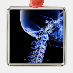 X-ray image of the bones of the neck metal tree decoration