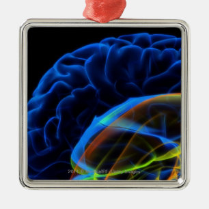 X-ray image of the brain metal ornament