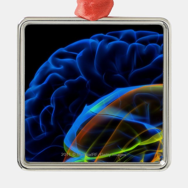 X-ray image of the brain metal ornament (Front)