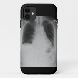 X Ray ~ iPhone 5 CaseMate case