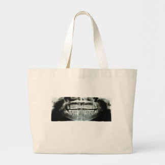 X-Ray Large Tote Bag