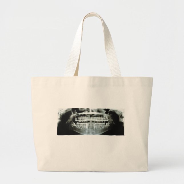 X-Ray Large Tote Bag (Front)