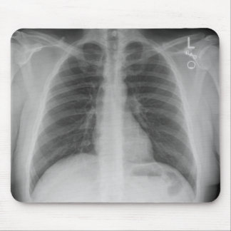 X-Ray Mousepad