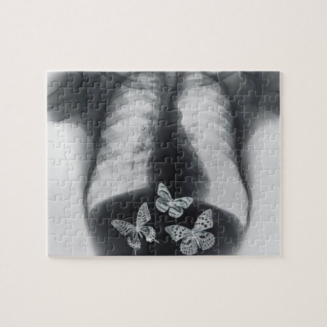 X-ray of butterflies in the stomach jigsaw puzzle (Horizontal)