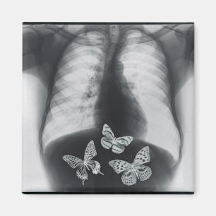 X-ray of butterflies in the stomach magnet