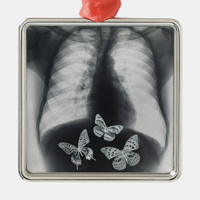 X-ray of butterflies in the stomach metal ornament (Front)