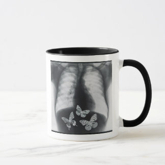 X-ray of butterflies in the stomach mug