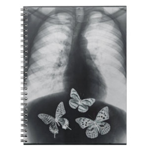 X-ray of butterflies in the stomach notebook