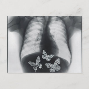 X-ray of butterflies in the stomach postcard
