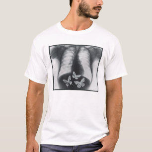 X-ray of butterflies in the stomach T-Shirt