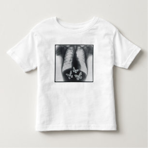 X-ray of butterflies in the stomach toddler T-Shirt