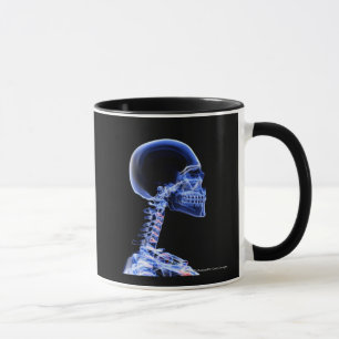 X-ray of the bones in the neck mug