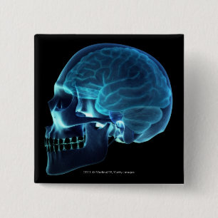 X-ray of the brain inside a skull 15 cm square badge